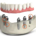 Business 1 image ABBOTSFORD DENTAL CLINIC dentist abbotsford in Collingwood VIC