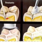 Business 1 image ACE DENTAL Dentist in Southport QLD