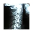 Business 2 image APPLECROSS CHIROPRACTIC CENTRE Whiplash in Applecross WA