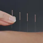 Business 1 image BALANCE COMPLEMENTARY MEDICINE Acupuncture Treatment in Melbourne VIC