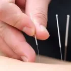 Business 2 image BAOLIN ACUPUNCTURE & CHINESE MEDICINE CENTRE Remedial Massage in Perth WA