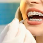Business 3 image BEST INVISALIGN DENTIST Oral Health in Collingwood VIC