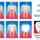 Business 3 image BRITE DENTAL GROUP wisdom teeth removal in Browns Plains QLD