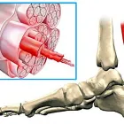 Business 3 image CITY PHYSIOTHERAPY & SPORTS INJURY CLINIC Remedial Massage Therapy in Adelaide SA