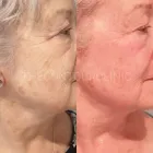 Business 2 image CONTOUR CLINICS Skin Treatments & Skin Clinics in Five Dock NSW