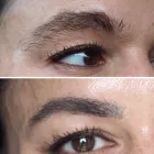 Business 4 image CONTOUR CLINICS Skin Treatments & Skin Clinics in Five Dock NSW