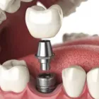 Business 2 image DAINTY DENTAL CARE Dentists in Bayswater VIC