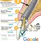 Business 3 image DENTAL IMPLANT PLACEMENTS PERTH tooth screw in Perth WA