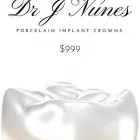 Business 4 image DENTAL IMPLANT PLACEMENTS PERTH tooth screw in Perth WA