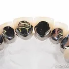 Business 1 image DENTIST COLLINGWOOD wisdom teeth removal in Collingwood VIC