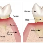Business 2 image DENTIST COLLINGWOOD wisdom teeth removal in Collingwood VIC