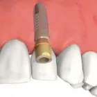 Business 3 image DENTIST COLLINGWOOD wisdom teeth removal in Collingwood VIC