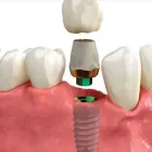 Business 4 image DENTIST COLLINGWOOD wisdom teeth removal in Collingwood VIC