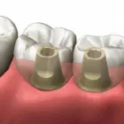 Business 5 image DENTIST COLLINGWOOD wisdom teeth removal in Collingwood VIC