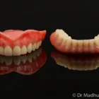 Business 6 image DENTIST COLLINGWOOD wisdom teeth removal in Collingwood VIC