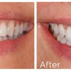Business 1 image DONCASTER HILL DENTAL - BEST TOOTH IMPLANTS IN MELBOURNE Dentist in Doncaster VIC