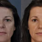 Business 3 image DR HODGKINSON Cosmetic Surgery &/or Procedures in Sydney NSW