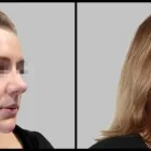 Business 2 image DR JOSEPH RIZK - PLASTIC & RECONSTRUCTIVE SURGEON Plastic & Reconstructive Surgery in Stanmore NSW