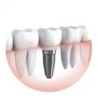 Business 1 image DR PAULO PINHO Wisdom Teeth Removal Cost in Sydney NSW
