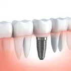Business 1 image DR THOMAS JOSEPH - DENTIST MELBOURNE CBD Root Canal Treatment in Melbourne VIC