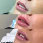 Business 5 image DRPATELCHATSWOODCOSMETIC Skin Treatments & Skin Clinics in Chatswood NSW