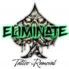 Business 2 image ELIMINATE TATTOO REMOVAL Tattoo Removal Newcastle in Mayfield NSW