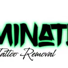 Business 3 image ELIMINATE TATTOO REMOVAL Tattoo Removal Newcastle in Mayfield NSW