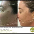 Business 2 image FIRST IMPRESSIONS LASER CLINIC Tattoo Removal in Melbourne VIC