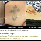 Business 4 image FIRST IMPRESSIONS LASER CLINIC Tattoo Removal in Melbourne VIC