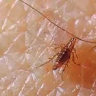 Business 2 image FLEA PEST CONTROL PERTH Pest Control in Perth WA