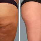 Business 1 image FRESH SKIN CANVAS Tattoo Removal in Melbourne VIC