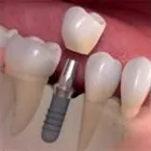 Business 1 image HOLISTIC DENTAL Emergency Dental Service in Melbourne VIC