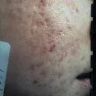 Business 2 image INSTANT LASER CLINIC Tattoo Removal in Kew VIC