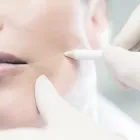 Business 2 image LASER CLINICS AUSTRALIA - BOORAGOON Skin Care Clinic in Booragoon WA