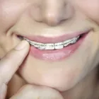 Business 4 image MARKETPLACE DENTAL CENTRE wisdom teeth removal in Wagga Wagga NSW