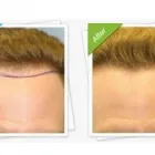 Business 3 image MEDIHAIR HAIR TRANSPLANT MELBOURNE Plastic Surgery in Melbourne VIC
