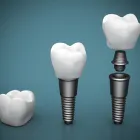 Business 2 image MELBOURNE DENTAL IMPLANT SPECIALIST - CAPTIVATE DENTAL Dentist in Melbourne VIC