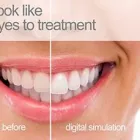Business 4 image MELBOURNE DENTIST Titanium Dental Implants in Melbourne VIC