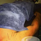 Business 5 image MOTION MYOTHERAPY NORTHCOTE REMEDIAL MASSAGE MELBOURNE Remedial Massage Therapy in Northcote VIC