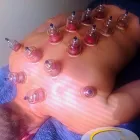 Business 20 image MOTION MYOTHERAPY NORTHCOTE REMEDIAL MASSAGE MELBOURNE Remedial Massage Therapy in Northcote VIC