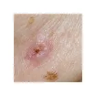 Business 1 image MY SKIN CENTRE Skin Cancer Clinic in Mount Hawthorn WA