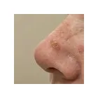 Business 2 image MY SKIN CENTRE Skin Cancer Clinic in Mount Hawthorn WA