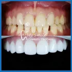Business 5 image MY SMILE COSMETIC DENTISTRY Teeth Whitening in Sydney NSW