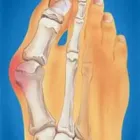 Business 2 image OXFORD STREET PODIATRY Warts in Mount Hawthorn WA