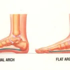 Business 5 image OXFORD STREET PODIATRY Warts in Mount Hawthorn WA