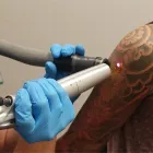 Business 3 image REMOVERY Tattoo Removal Service in Ringwood VIC