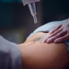 Business 1 image REVIVAL LASER CLINIC Tattoo Removal in Caloundra QLD