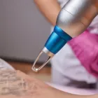 Business 2 image REVIVAL LASER CLINIC Tattoo Removal in Caloundra QLD