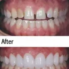 Business 2 image SANDSTONE POINT DENTAL Dentist in Sandstone Point QLD