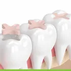 Business 3 image SERENITY SMILES DENTAL Health & Fitness - Centres & Services in Sydney NSW